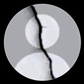 Ng