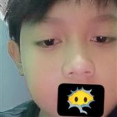Vỡ